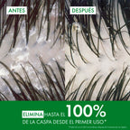 Shampoo Anticaspa Vichy Dercos para Cabello Graso - 390ml