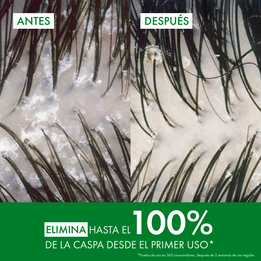 Shampoo Anticaspa Vichy Dercos para Cabello Graso - 390ml